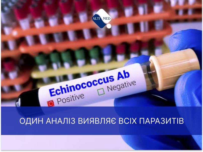 Один анализ выявляет всех паразитов